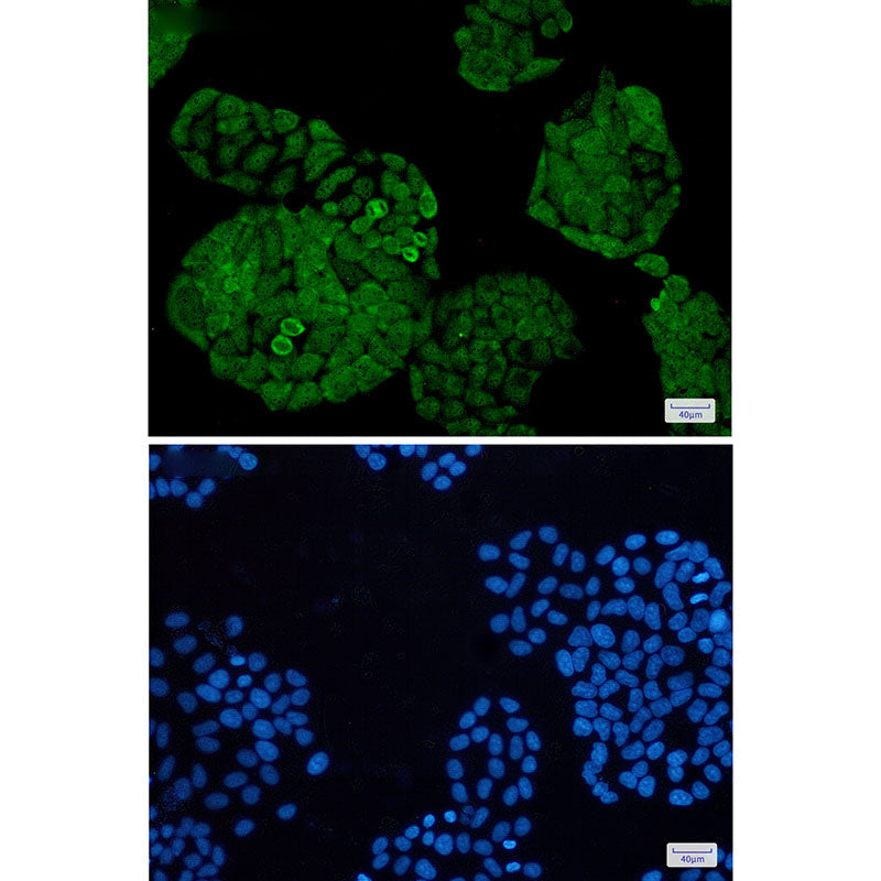 Anti-UCHL5 Rabbit Monoclonal Antibody