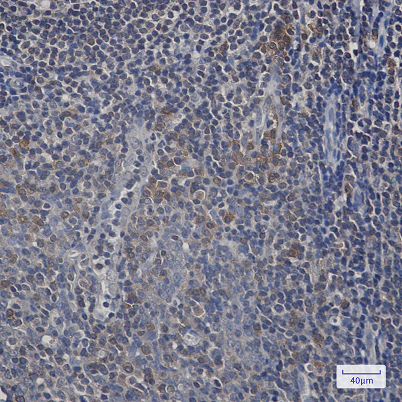 Anti-UFC1 Rabbit Monoclonal Antibody