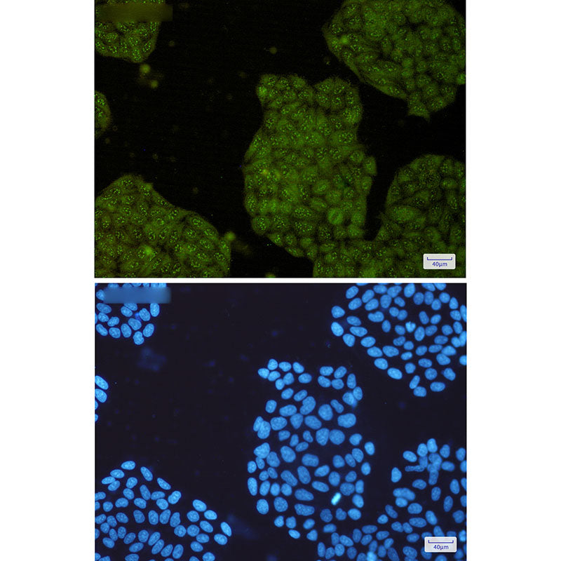 Anti-UFC1 Rabbit Monoclonal Antibody
