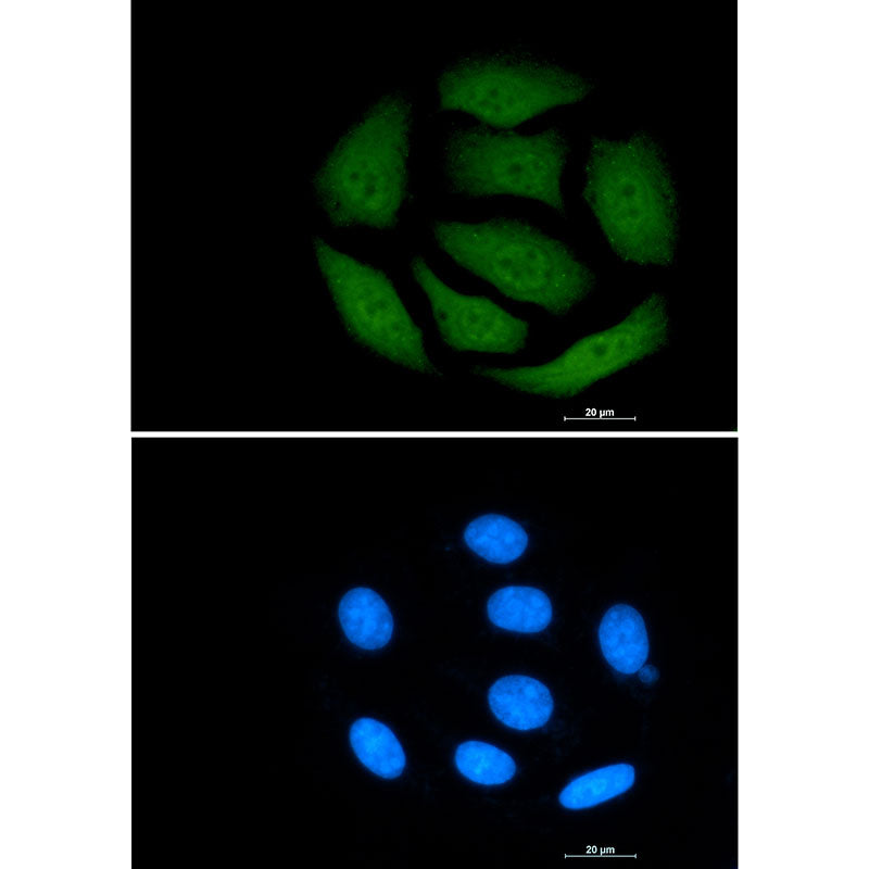 Anti-VCP Rabbit Monoclonal Antibody