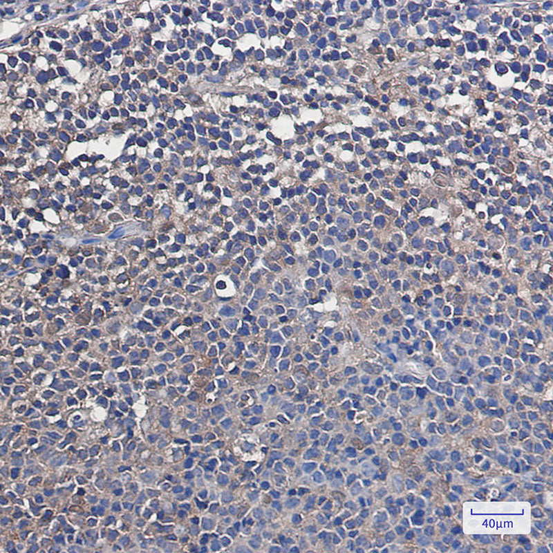 Anti-VCP Rabbit Monoclonal Antibody