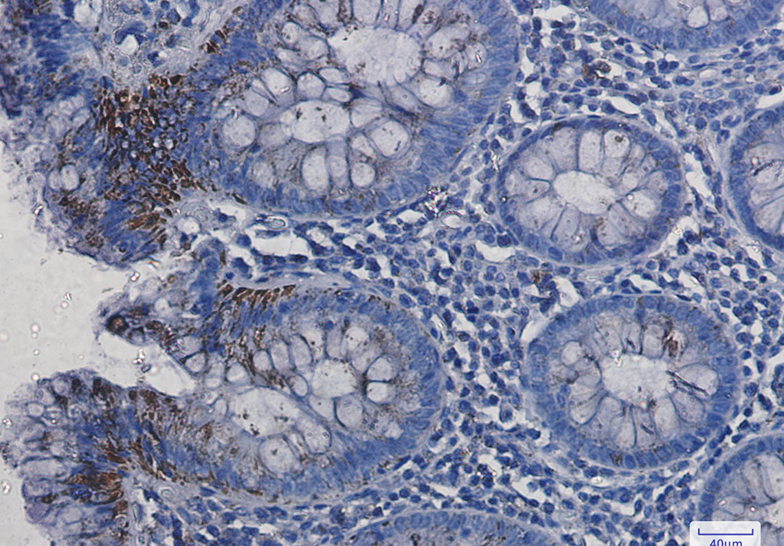 Anti-VDAC1 Rabbit Monoclonal Antibody