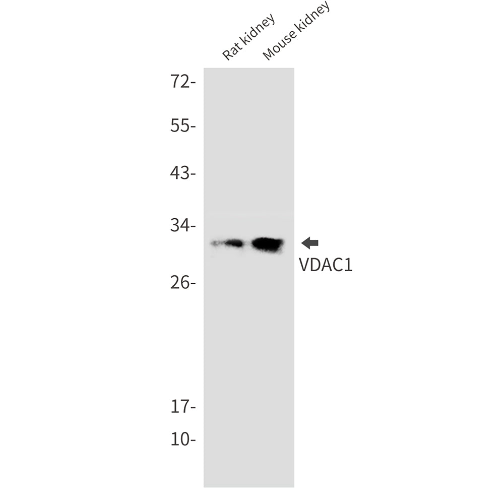Anti-VDAC1 Rabbit Monoclonal Antibody