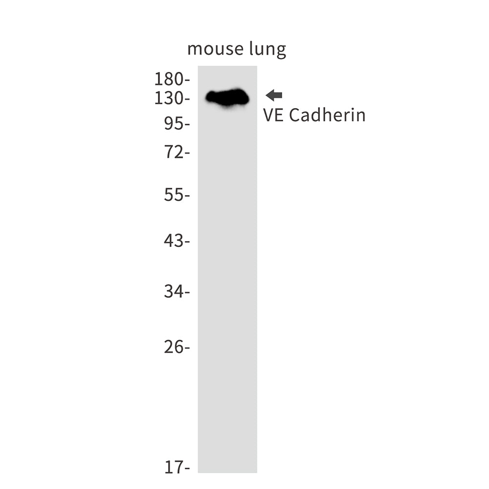 Anti-Cadherin 5 Rabbit Monoclonal Antibody