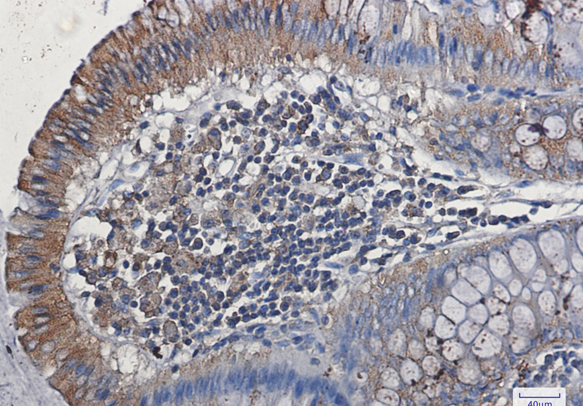 Anti-VEGF Receptor 1 Rabbit Monoclonal Antibody
