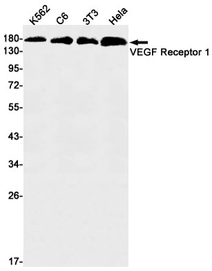 Anti-VEGF Receptor 1 Rabbit Monoclonal Antibody