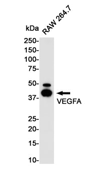 Anti-VEGFA Rabbit Monoclonal Antibody