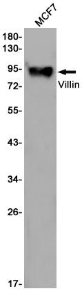 Anti-Villin Rabbit Monoclonal Antibody