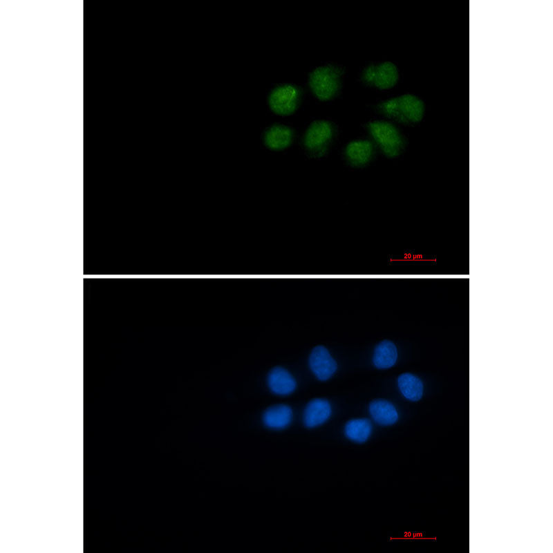 Anti-Phospho-Vimentin (Ser56) Rabbit Monoclonal Antibody