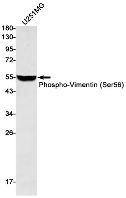 Anti-Phospho-Vimentin (Ser56) Rabbit Monoclonal Antibody