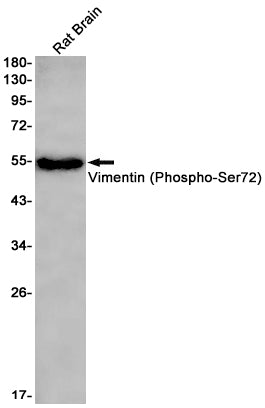 Anti-Phospho-Vimentin (Ser72) Rabbit Monoclonal Antibody