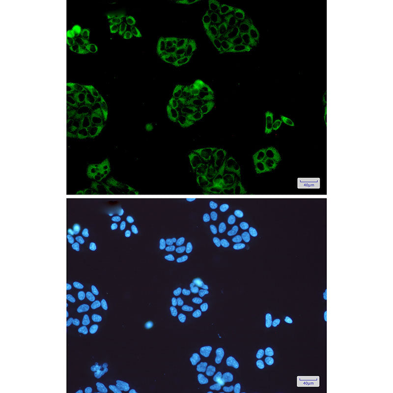 Anti-Vinculin Rabbit Monoclonal Antibody