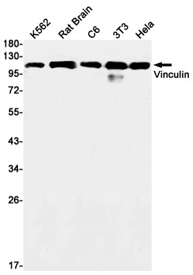 Anti-Vinculin Rabbit Monoclonal Antibody