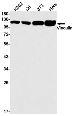 Anti-Vinculin Rabbit Monoclonal Antibody