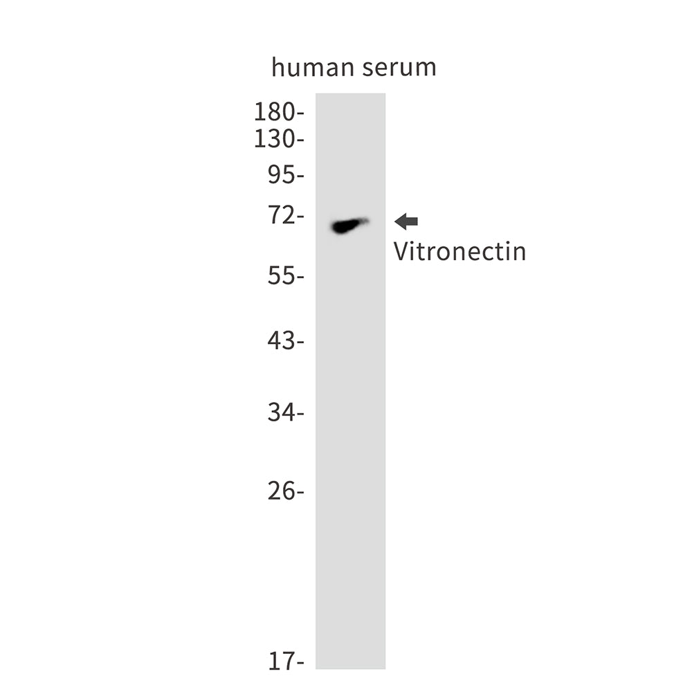 Anti-Vitronectin Rabbit Monoclonal Antibody