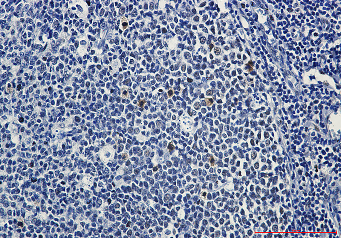 Anti-Phospho-c Myb (Ser11) Rabbit Monoclonal Antibody