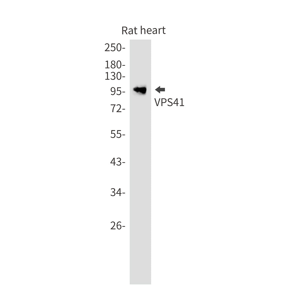 Anti-VPS41 Rabbit Monoclonal Antibody