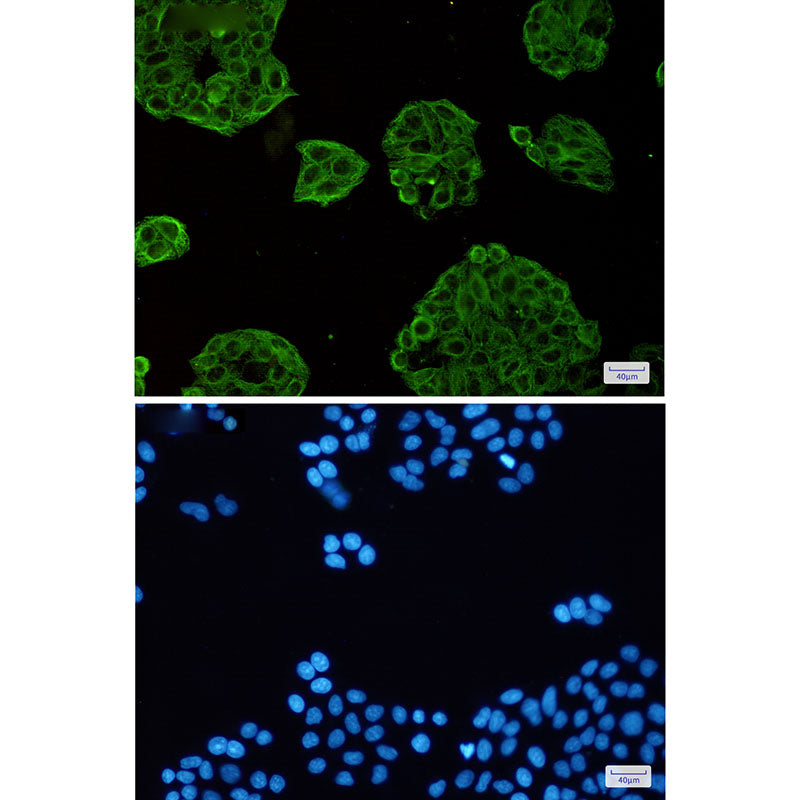Anti-VPS4A Rabbit Monoclonal Antibody
