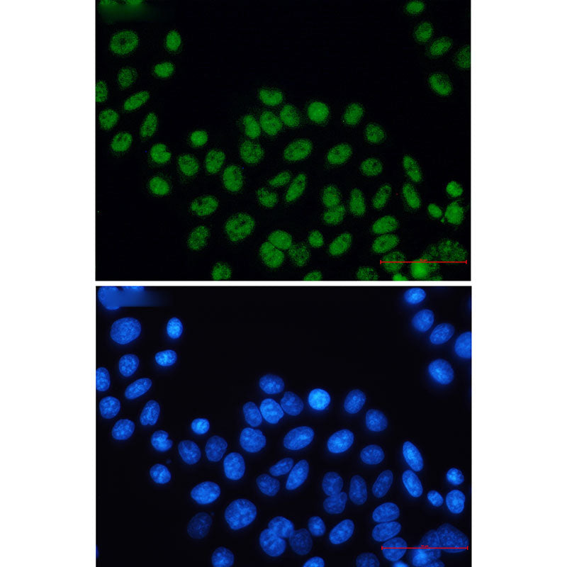 Anti-XPD Rabbit Monoclonal Antibody