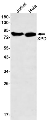 Anti-XPD Rabbit Monoclonal Antibody