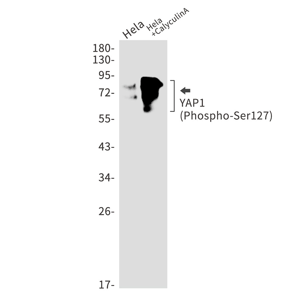Anti-Phospho-YAP1 (Ser127) Rabbit Monoclonal Antibody