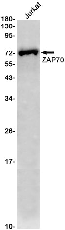 Anti-ZAP70 Rabbit Monoclonal Antibody