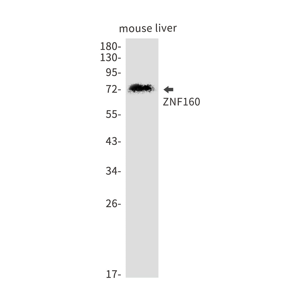 Anti-ZNF160 Rabbit Monoclonal Antibody