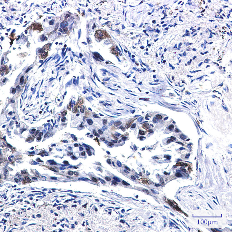 Anti-Tissue Factor Rabbit Monoclonal Antibody
