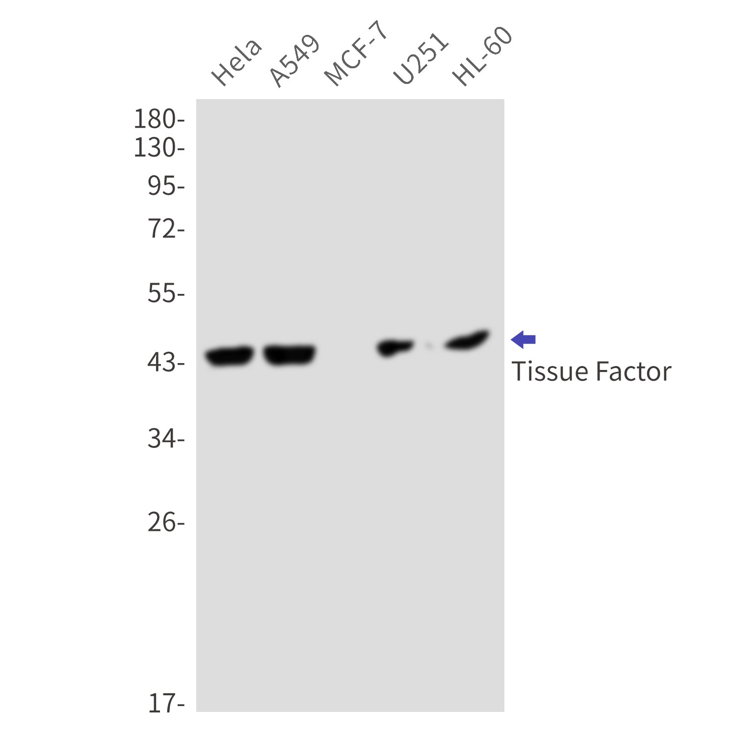Anti-Tissue Factor Rabbit Monoclonal Antibody