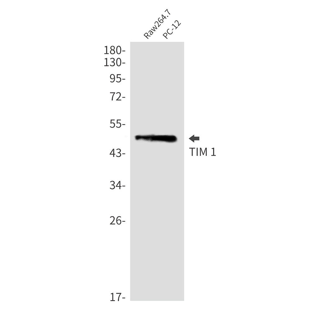 Anti-TIM 1 Rabbit Monoclonal Antibody