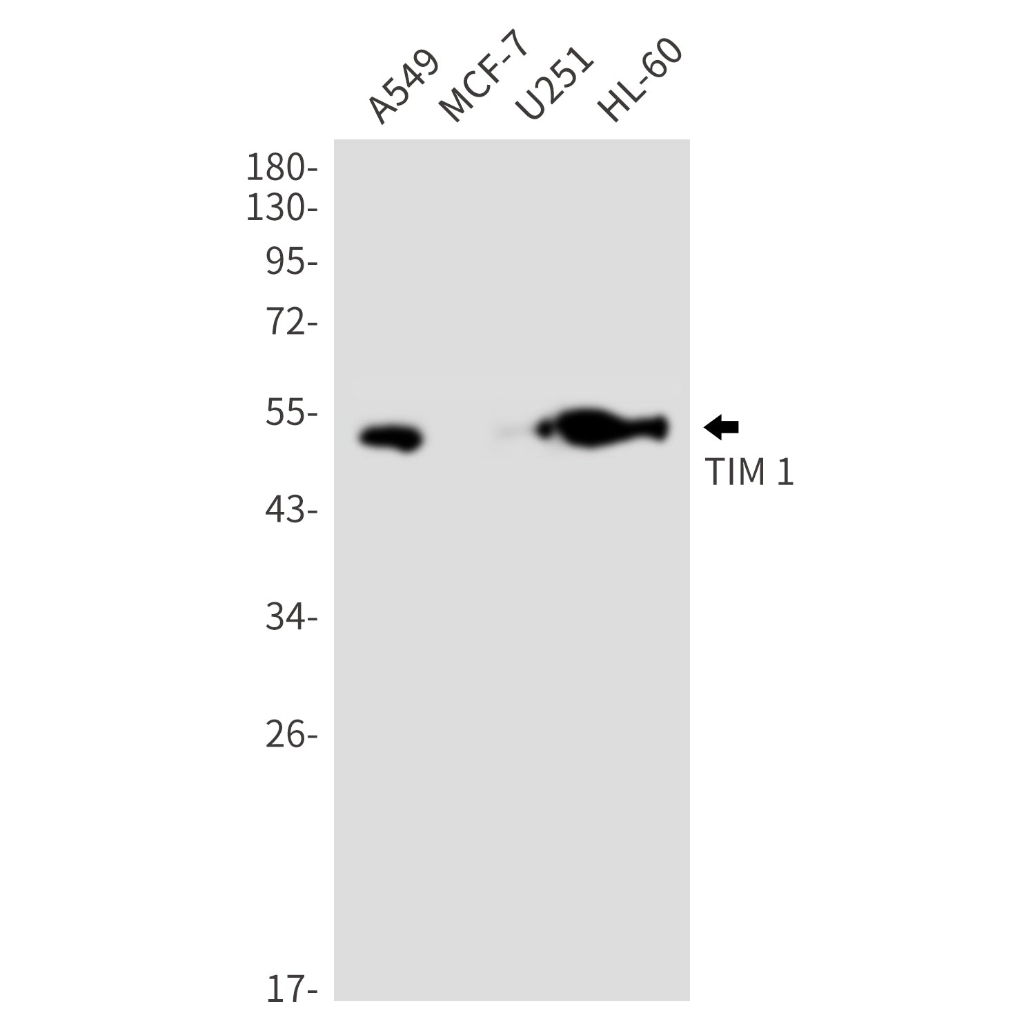 Anti-TIM 1 Rabbit Monoclonal Antibody