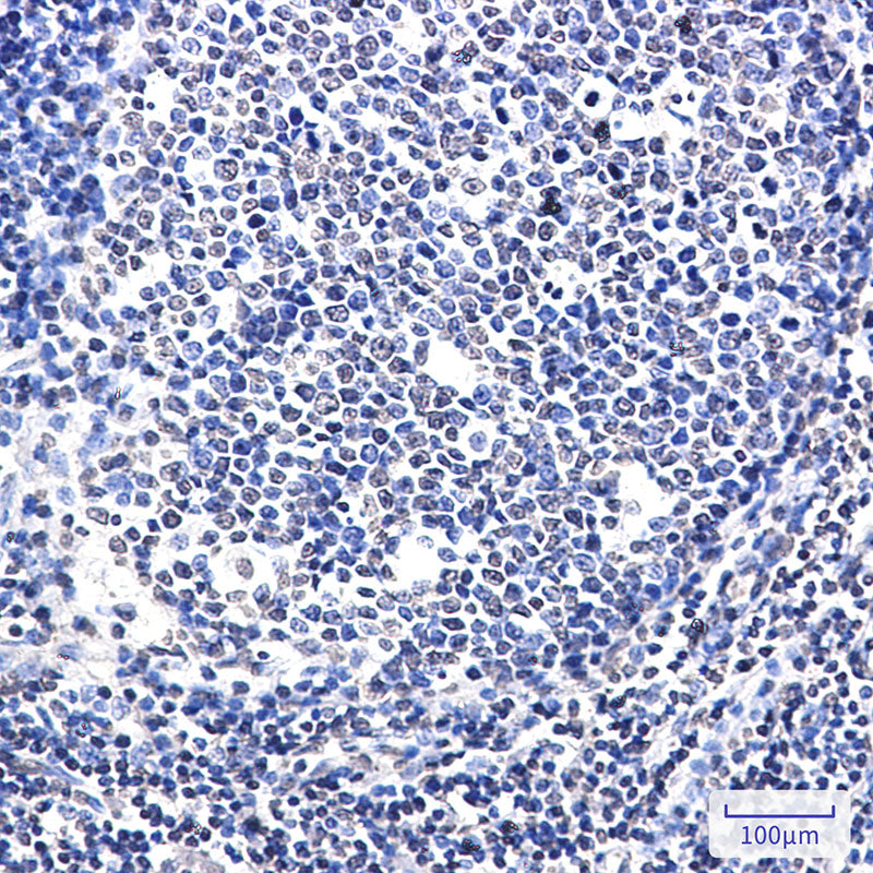 Anti-SATB1 Rabbit Monoclonal Antibody