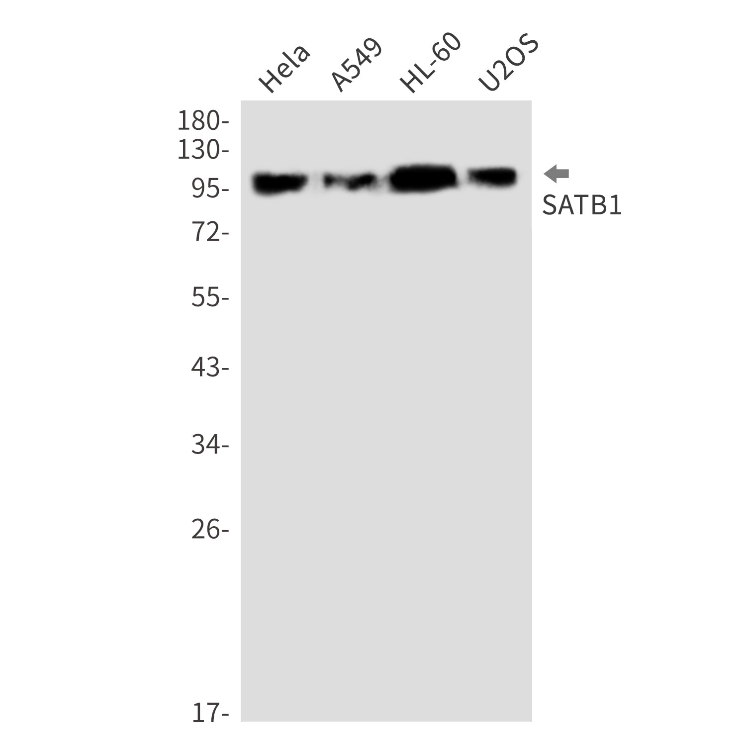 Anti-SATB1 Rabbit Monoclonal Antibody