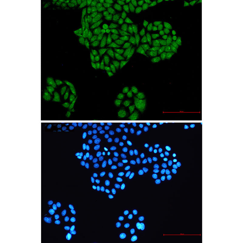 Anti-RYK Rabbit Monoclonal Antibody