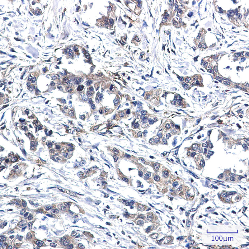 Anti-RYK Rabbit Monoclonal Antibody