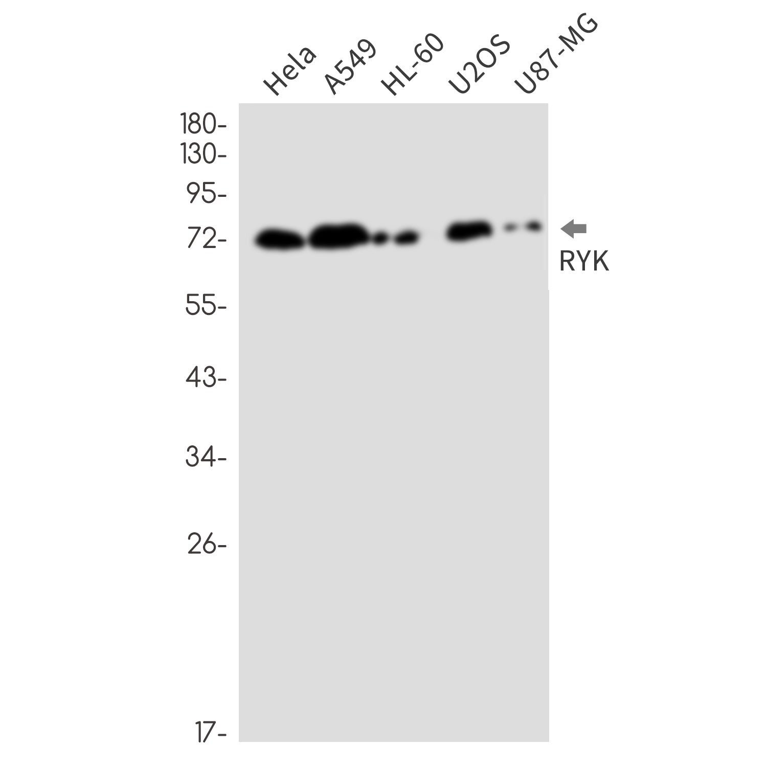 Anti-RYK Rabbit Monoclonal Antibody