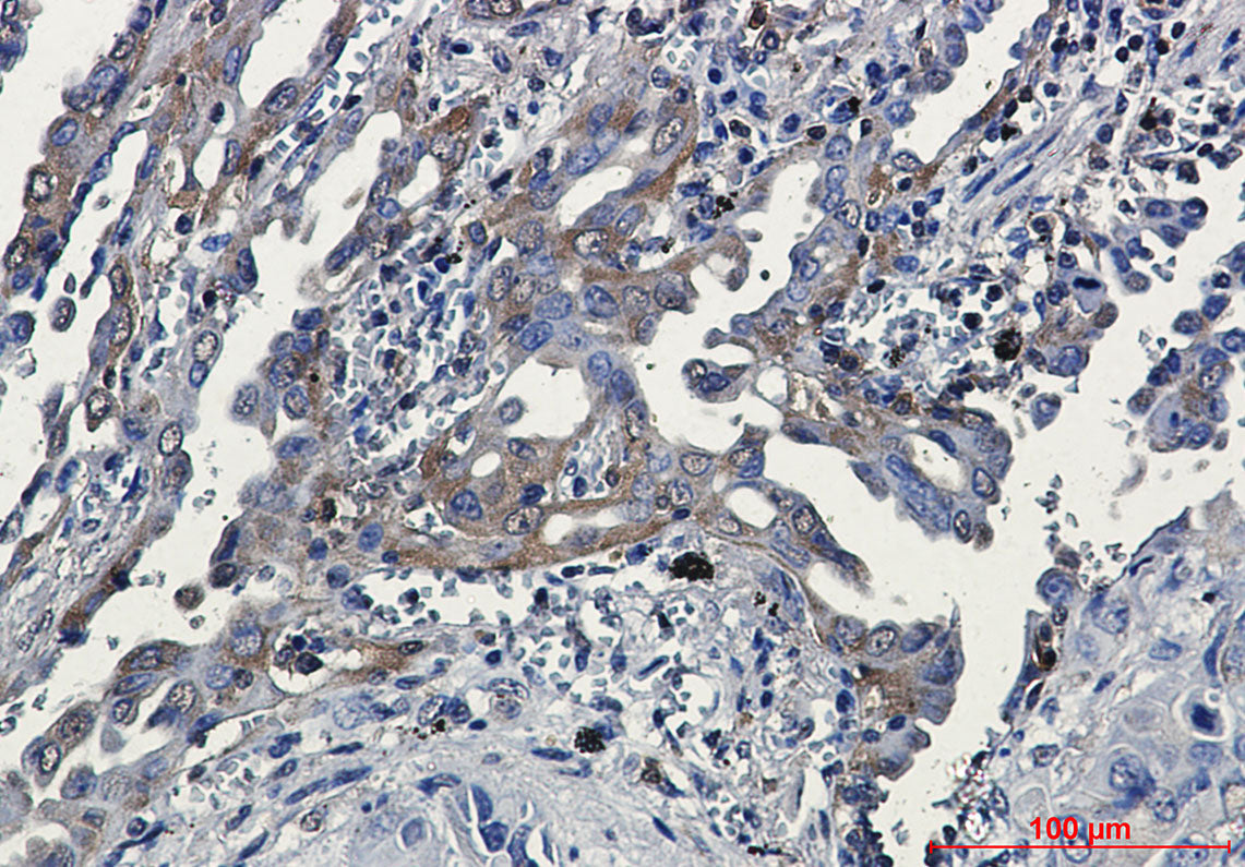 Anti-RSK3 Rabbit Monoclonal Antibody