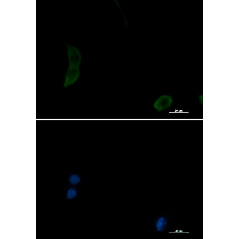 Anti-PAK1 Rabbit Monoclonal Antibody