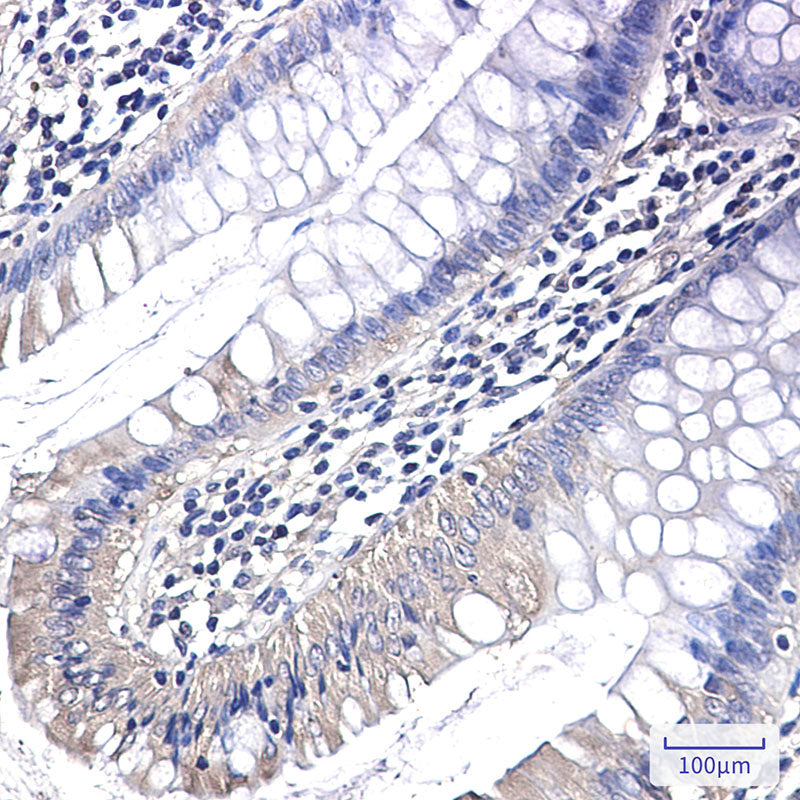 Anti-PAK1 Rabbit Monoclonal Antibody