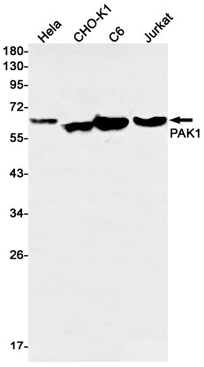 Anti-PAK1 Rabbit Monoclonal Antibody