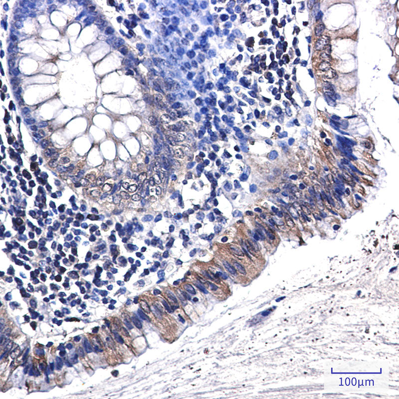 Anti-Osteopontin Rabbit Monoclonal Antibody