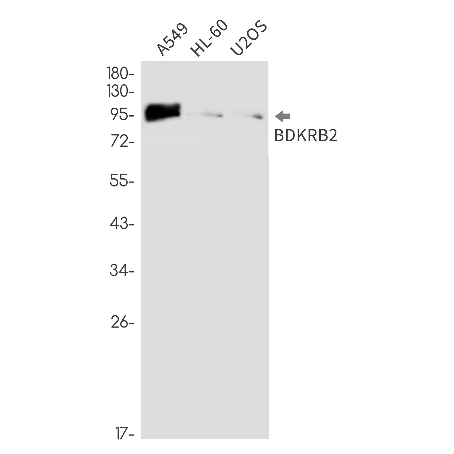 Anti-BDKRB2 Rabbit Monoclonal Antibody