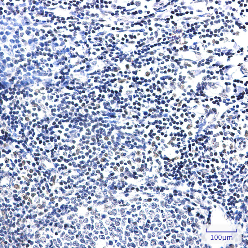 Anti-PIM1 Rabbit Monoclonal Antibody