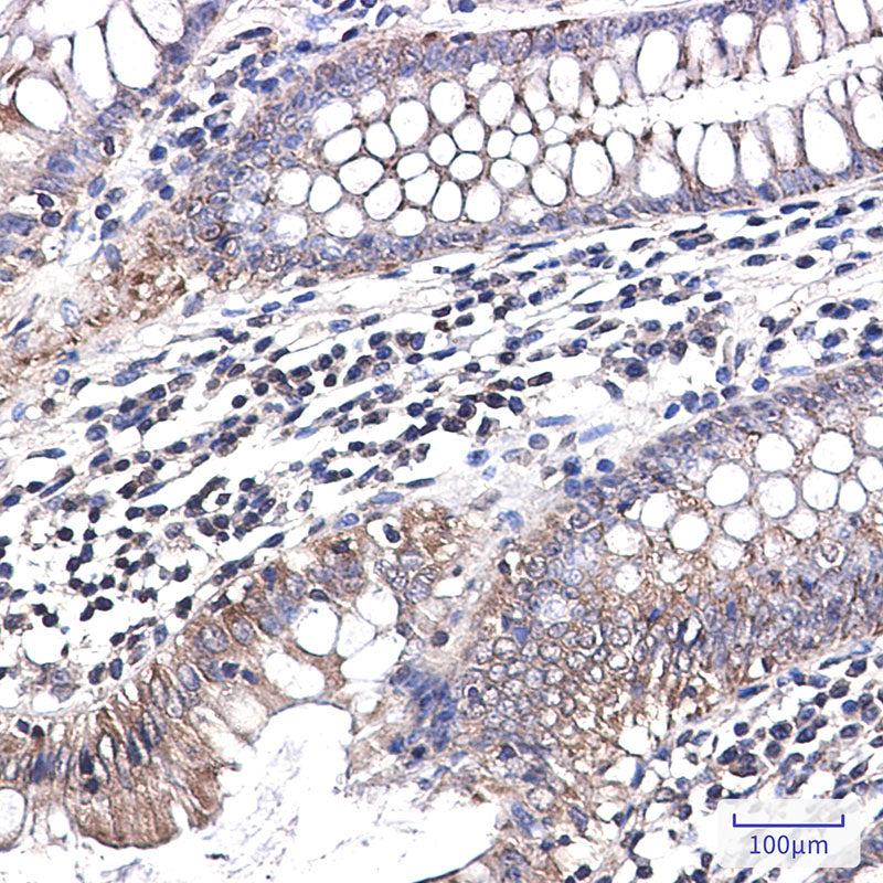 Anti-NDUFB1 Rabbit Monoclonal Antibody