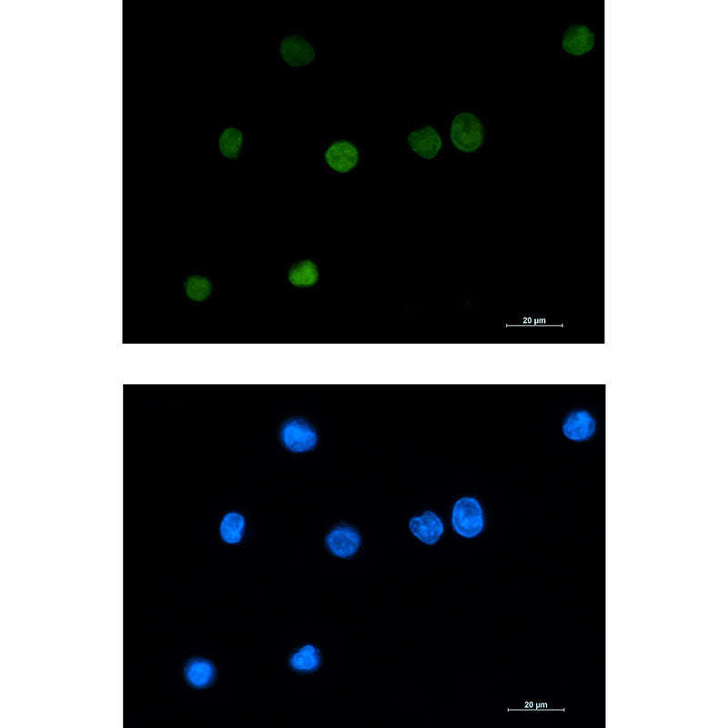Anti-Histone H1.2 Rabbit Monoclonal Antibody