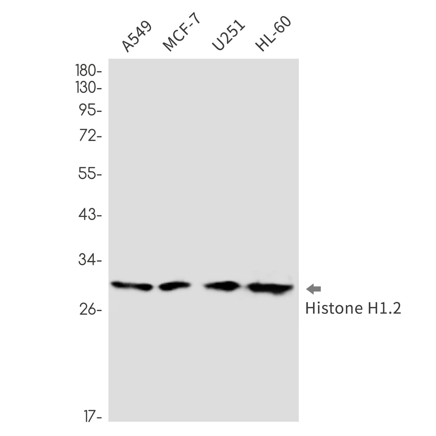 Anti-Histone H1.2 Rabbit Monoclonal Antibody