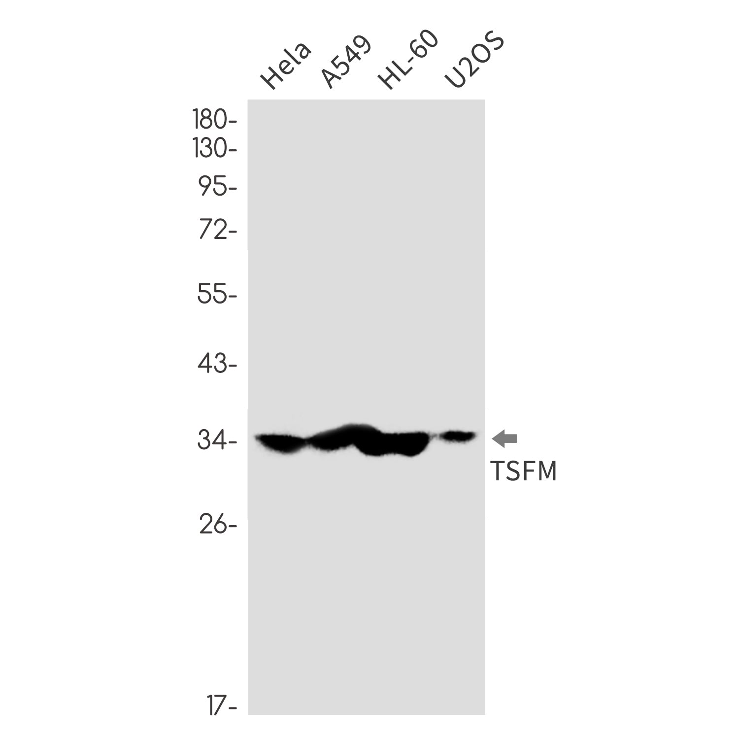 Anti-Elongation Factor Ts Rabbit Monoclonal Antibody