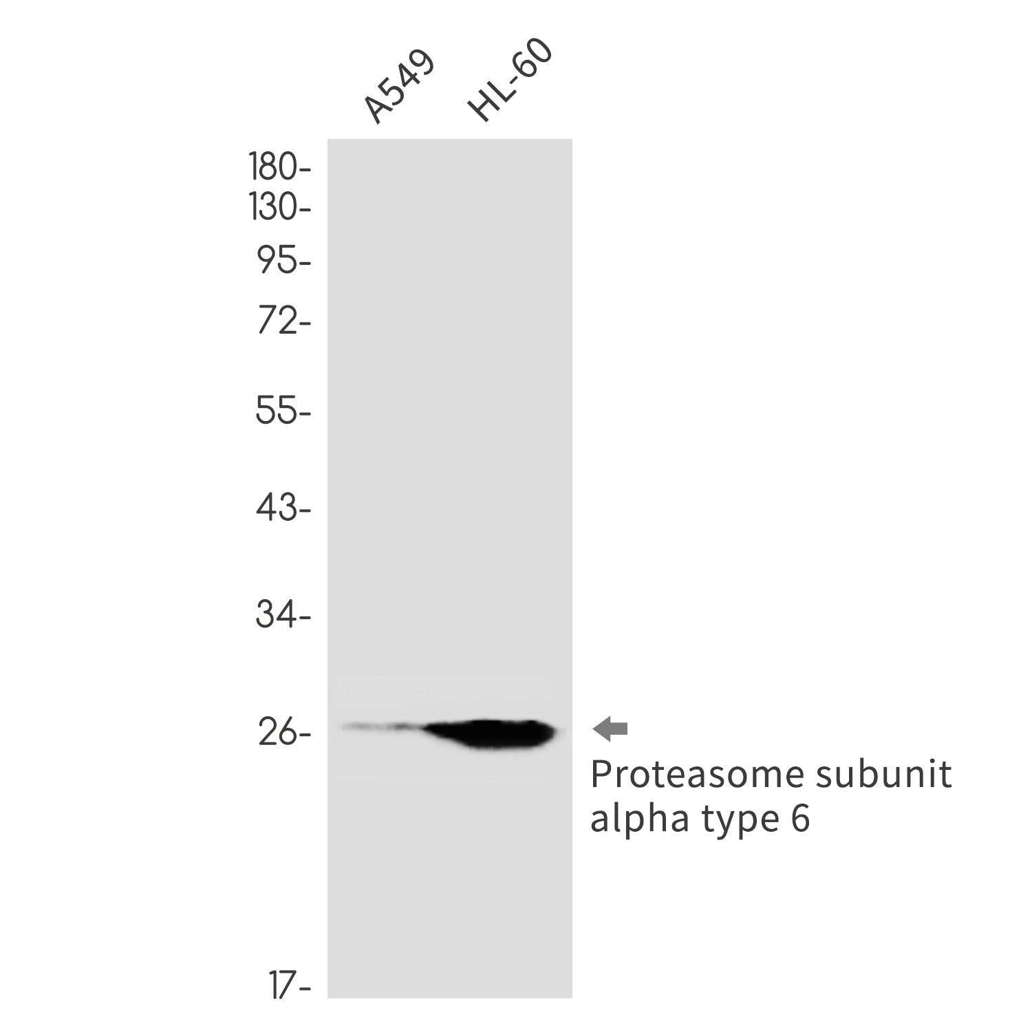 Anti-Proteasome alpha 6 Rabbit Monoclonal Antibody