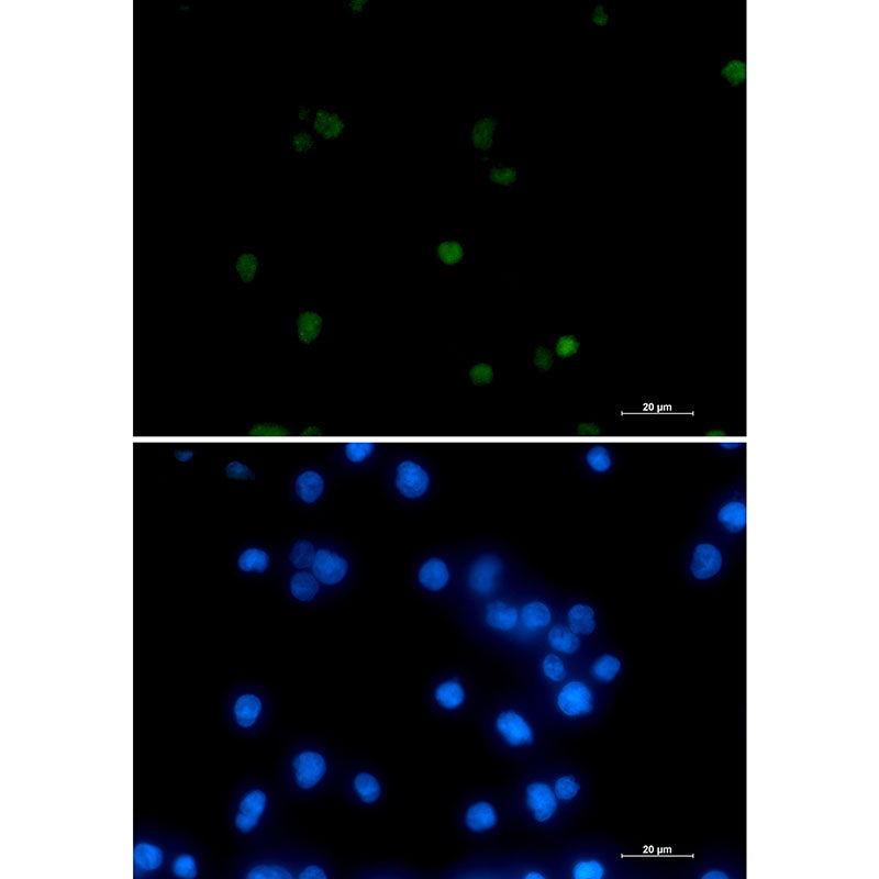 Anti-RNA Polymerase II Subunit B1 Rabbit Monoclonal Antibody