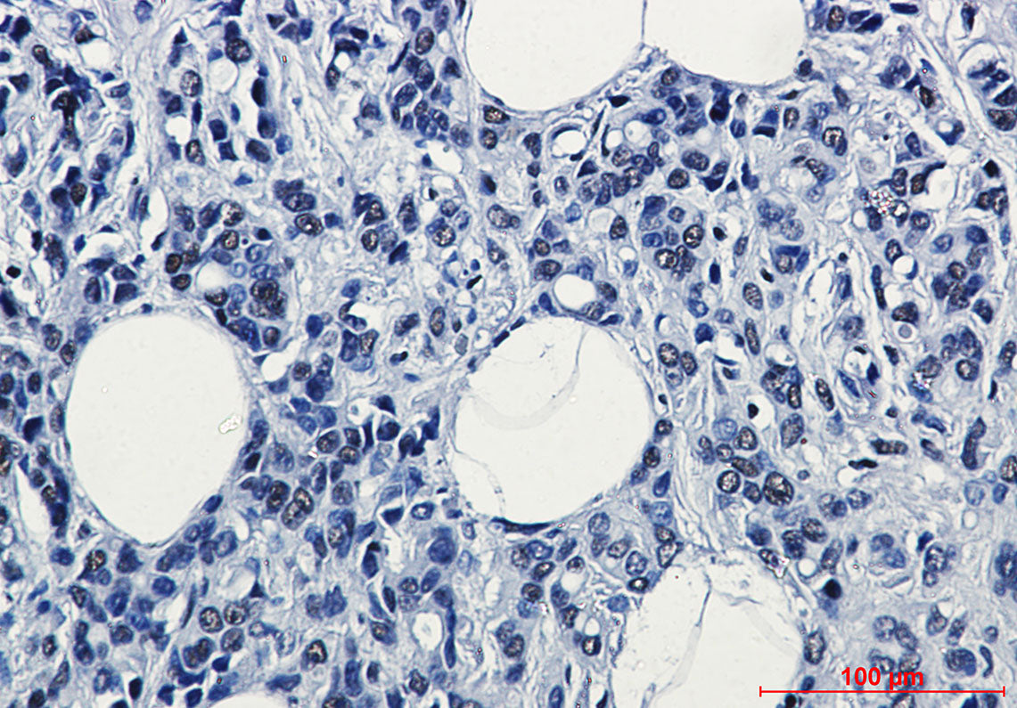 Anti-RNA Polymerase II Subunit B1 Rabbit Monoclonal Antibody